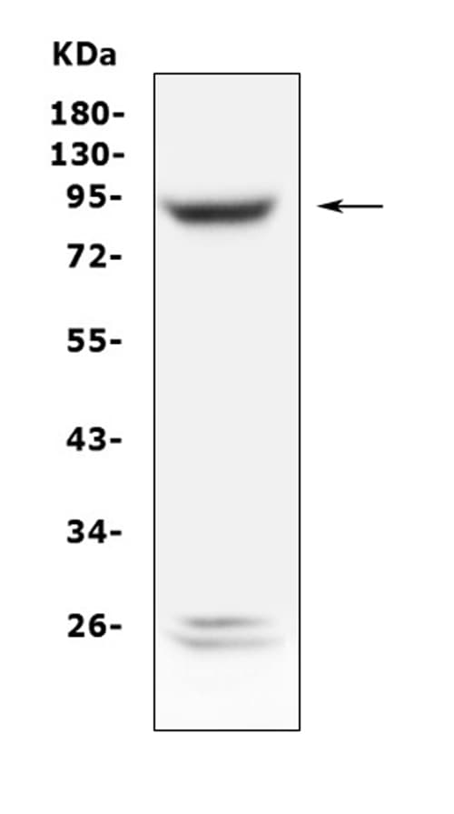 PLA2G6 / IPLA2 Antibody