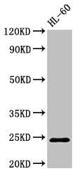 RAB5A / RAB5 Antibody