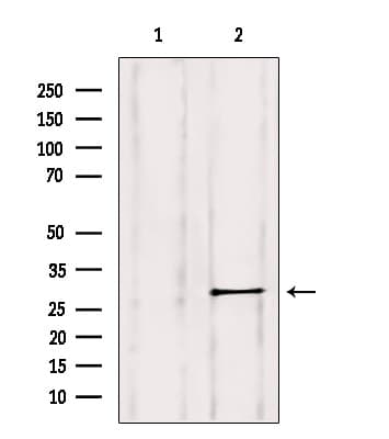 RAB11B Antibody