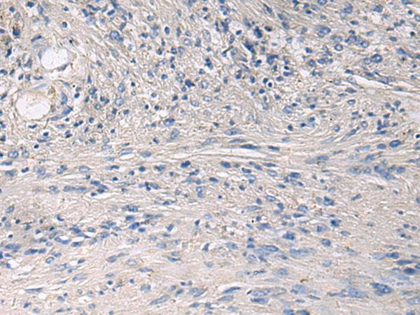 Polyclonal Rabbit anti-Human PRKCSH Antibody (IHC)