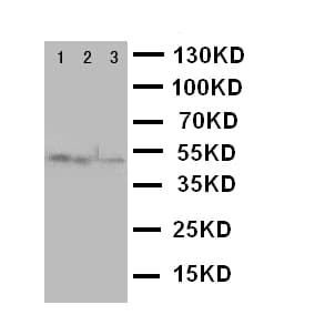 CXCR4 Antibody (aa31-43)