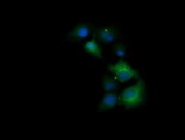 TRIM38 Antibody (clone OTI113D3)