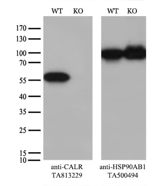 CALR / Calreticulin Antibody (clone OTI15F5)