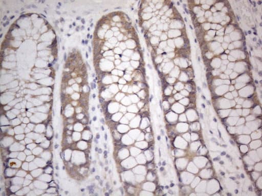 PRMT5 Antibody (aa238-499, clone OTI2H3, Carrier-free)