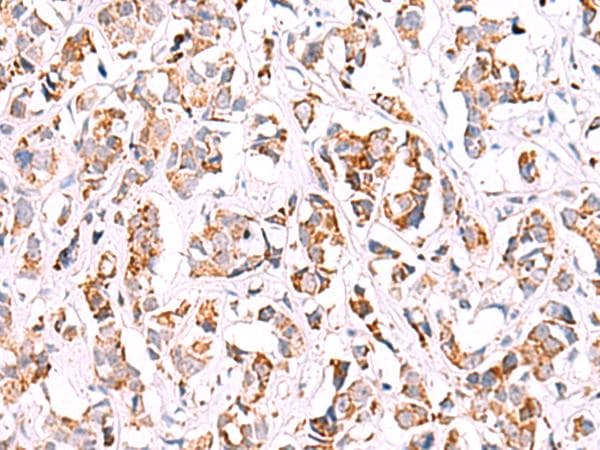 SIGLEC6 Antibody