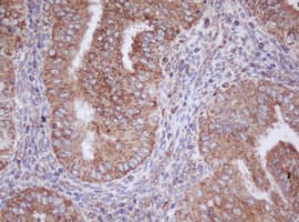 IF3mt / MTIF3 Antibody (aa56-278, clone OTI4B6)