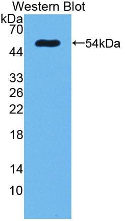 SCNN1A / ENaC Alpha Antibody (aa112-543, PE)