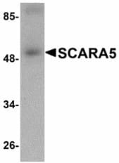 IHC-plus™ SCARA5 Antibody