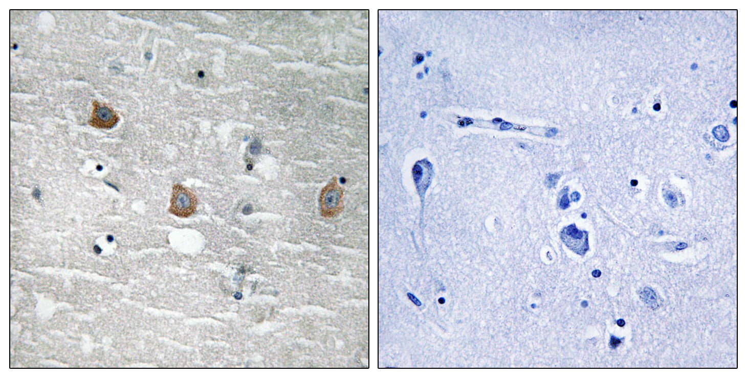 TOB1 / TOB Antibody (phospho-Ser164)