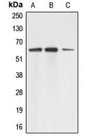 Polyclonal Rabbit anti-Human AAAS / Adracalin Antibody (C-Terminus, WB)