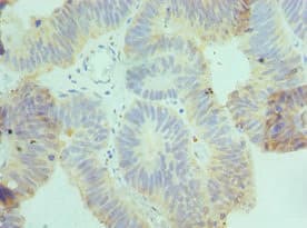 Polyclonal Rabbit anti-Human CSRNP1 / AXUD1 Antibody (aa1-200, IHC)