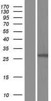 Human GSTO2 Protein (Over-Expression Lysate Myc-DDK (Flag))