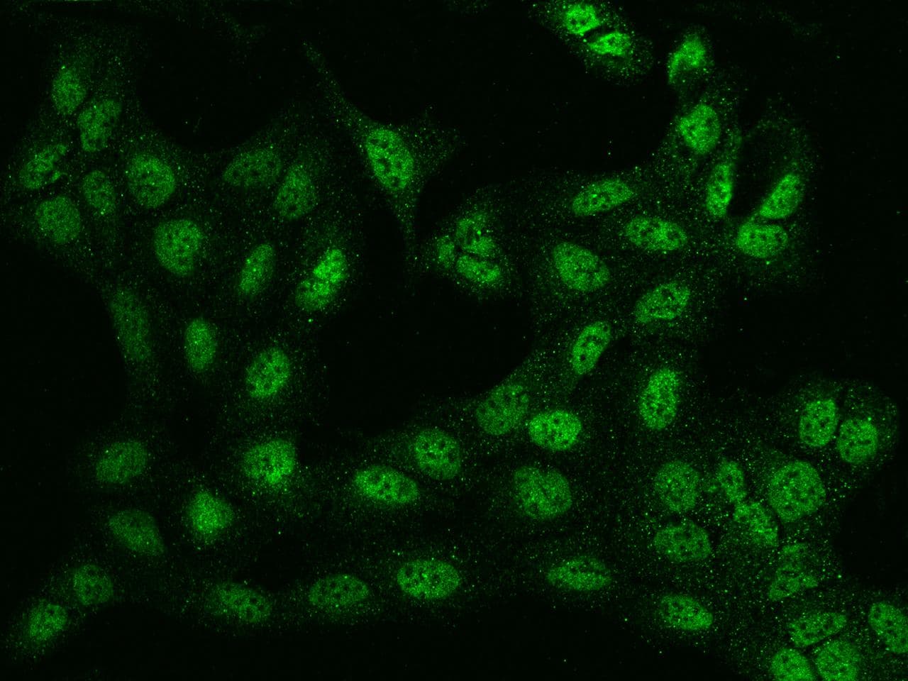 BTBD9 Antibody