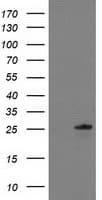 C1orf50 Antibody (clone OTI1B11)