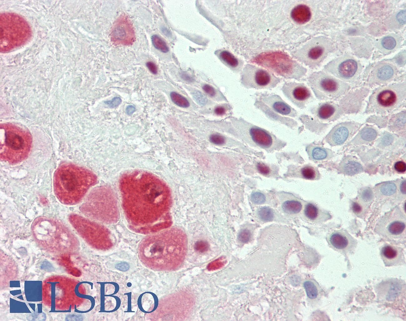 IHC-plus™ SERPINB2 / PAI-2 Antibody (clone 1G3)