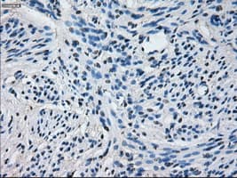 CYP2E1 Antibody (clone OTI5B9)