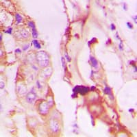PIK3R1/PIK3R3 Antibody (phospho-Tyr467/Tyr199)