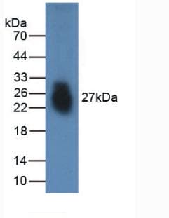 Human FNDC5 / Irisin Protein (Recombinant His, N-Terminal)