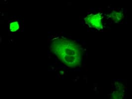 PKG / PRKG1 Antibody (clone OTI9A4)