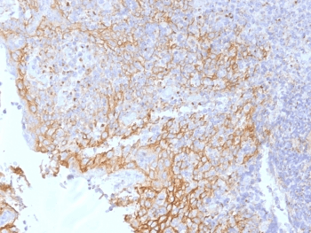 CTNNB1 / Beta Catenin Antibody (clone 5H10)