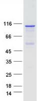 Human DSTYK / RIPK5 Protein (Recombinant Myc-DDK (Flag))