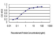 IHC-plus™ SPSB2 Antibody (clone 1E6)