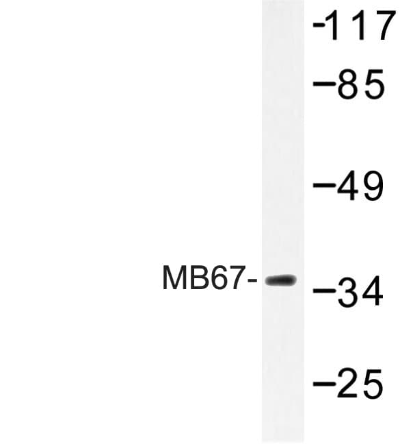 NR1I3 / CAR Antibody (Thr102)