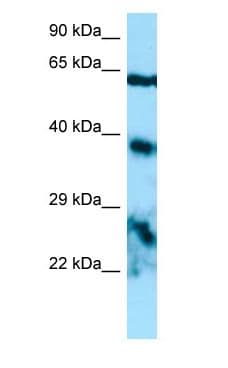DSPG3 / Epiphycan Antibody (aa148-197)