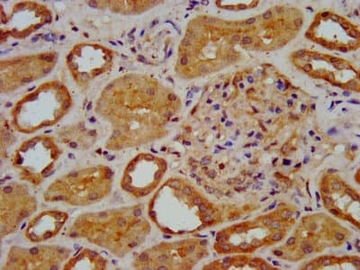 Polyclonal Rabbit anti-Human ELP3 Antibody (IF, WB)
