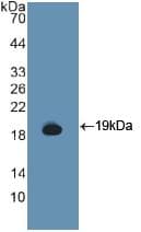 CSF3R / CD114 Antibody (aa271-428)