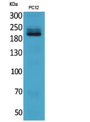 ITGB4 / Integrin Beta 4 Antibody