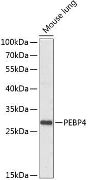 Polyclonal Rabbit anti-Human PEBP4 Antibody (WB)