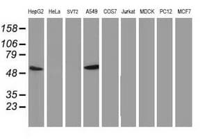 TP53 / p53 Antibody (clone OTI2C4)