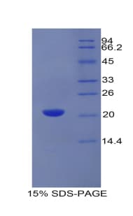 Rat GAS6 Protein (Recombinant His)