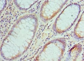 SMC1A / SMC1 Antibody (aa1-130)