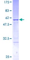 Human D52 / TPD52 Protein (Recombinant GST)