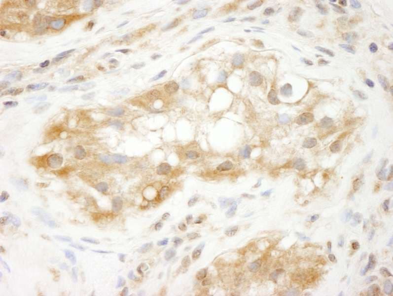 TRIM3 Antibody (aa1-50)