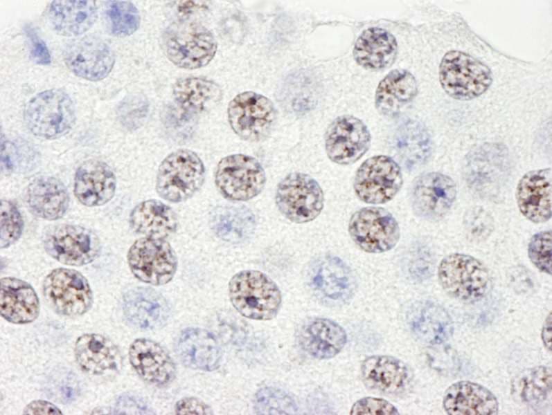 SART3 Antibody (aa600-650)