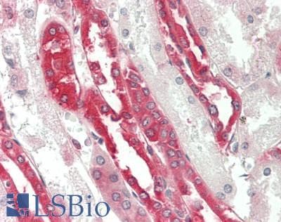 IHC-plus™ HSPA5 / GRP78 / BiP Antibody (C-Terminus)