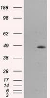 Monoclonal Mouse anti-Human HMRF1L / MTRF1L Antibody (clone OTI1H5, IHC, IF, WB)
