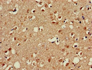 OTX1 Antibody