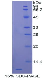 Rat APOC3 / Apolipoprotein C III (Recombinant His)
