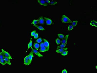Polyclonal Rabbit anti-Human CEP83 / CCDC41 Antibody (IHC, IF, WB)