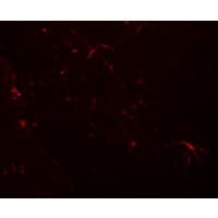 IHC-plus™ TMEM204 Antibody