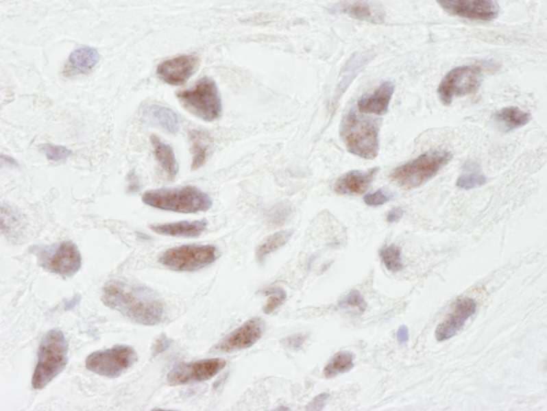 PPP1R10 / PNUTS Antibody (aa350-400)