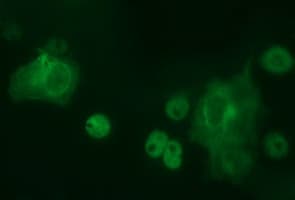 PathPlus™ TH / Tyrosine Hydroxylase Antibody (clone OTI3H3)