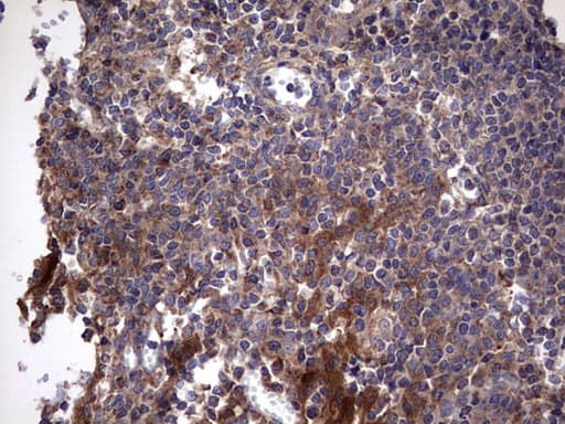 IL1RN Antibody (clone OTI2B1)