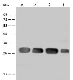 Polyclonal Rabbit anti-Human DENR / Density Regulated Antibody (IHC, IF, WB)