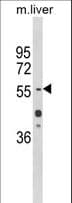 HNF1A / HNF1 Antibody (aa177-205)