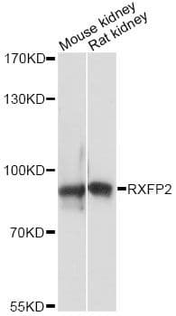 Polyclonal Rabbit anti-Human RXFP2 / LGR8 Antibody (WB)